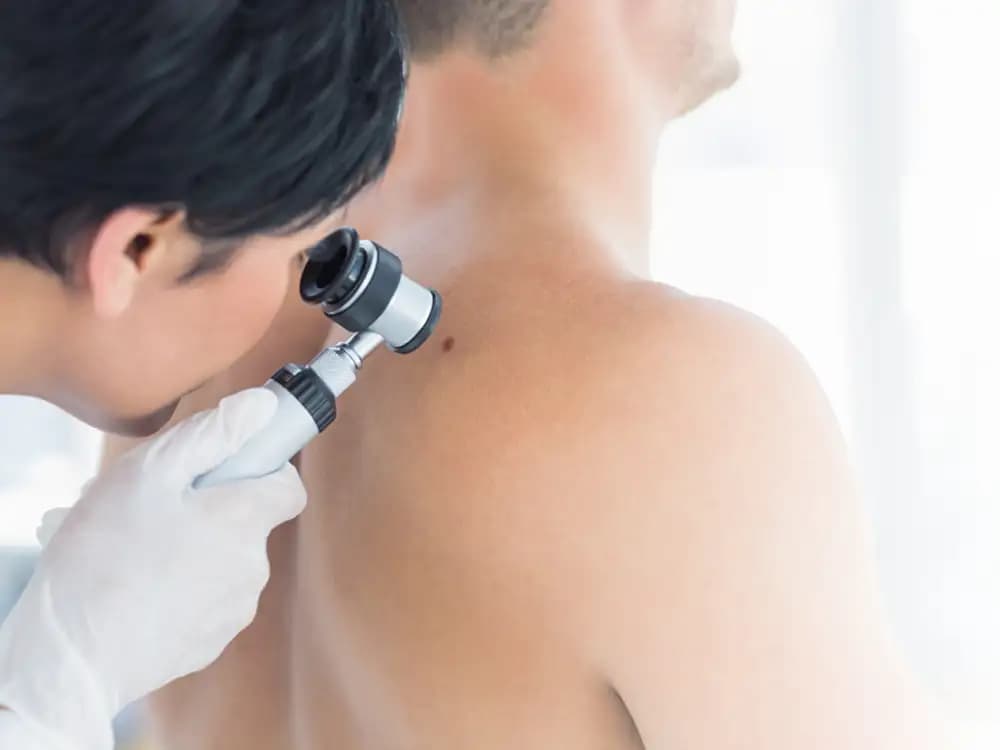 Dermatoskopowa analiza znamion z konsultacją lekarską