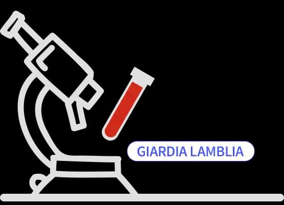 Giardia lamblia IgM/IgG