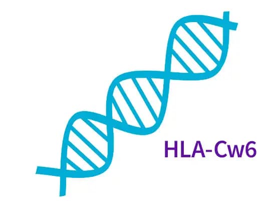 Łuszczyca – badanie HLA-Cw6