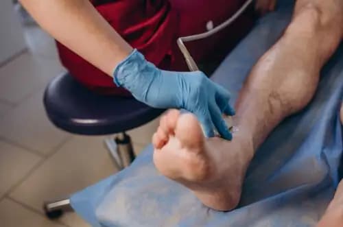 USG Doppler tętnic kończyn dolnych - jedna noga