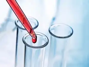 Przeciwciała IgG w organizmie. Jakie informacje dają Pacjentowi?